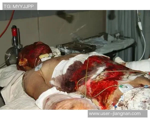 杨某在踢足球时意外受伤引发的医疗救助与运动安全问题探讨